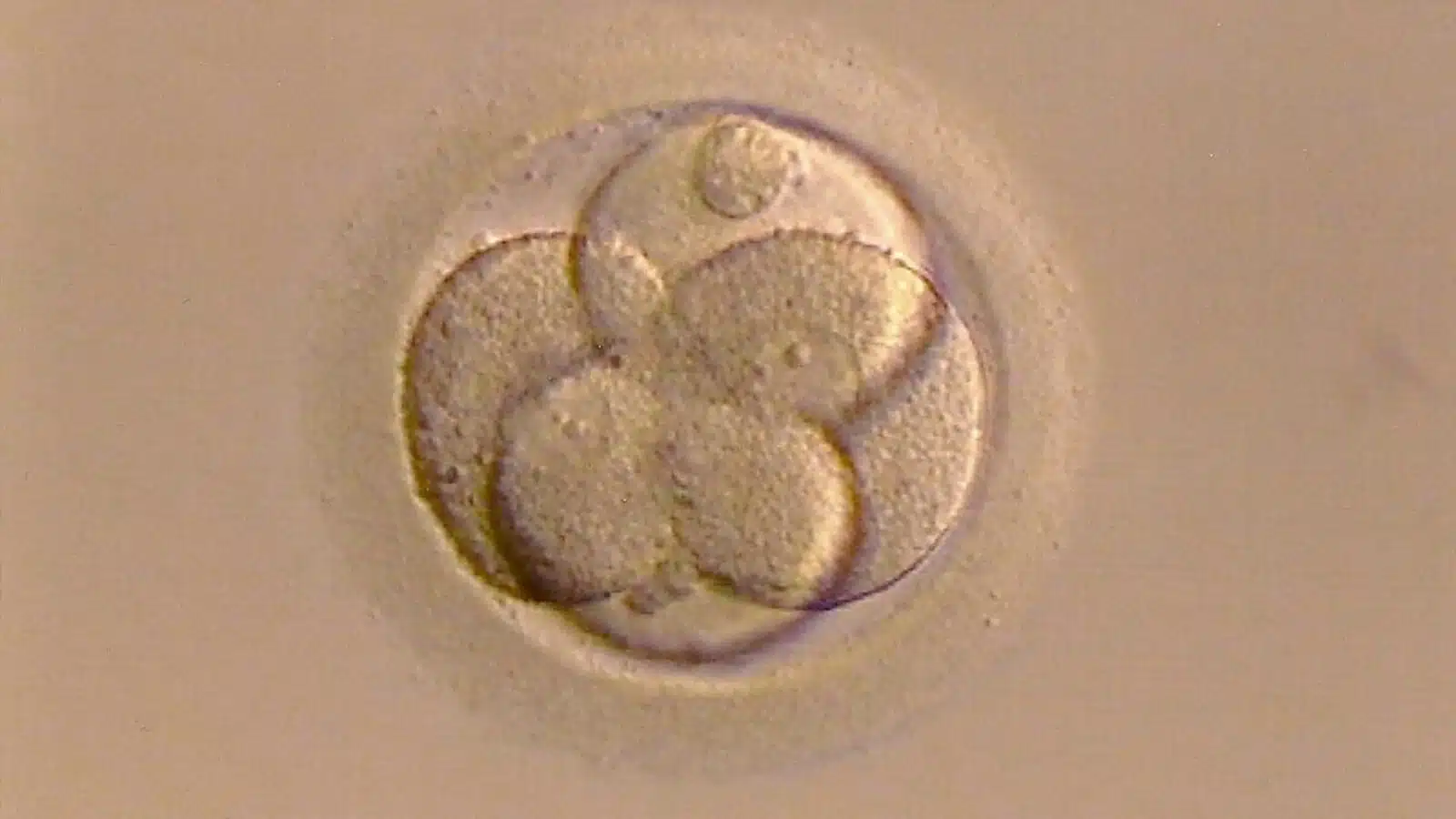 Vedere microscopică a unui embrion în curs de dezvoltare în stadiu incipient.